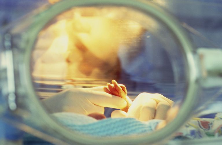 Minggu Bayi Pramatang Mengikut Minggu